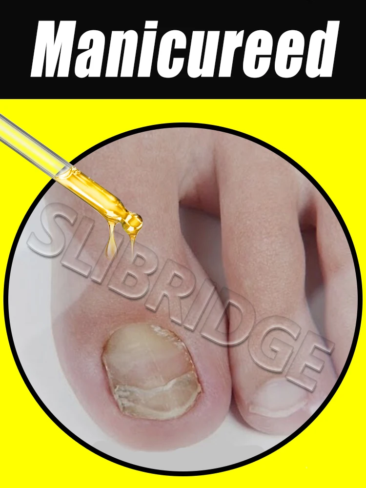 

Free shipping,Hot cleaning nail brush tools, plastic vacuum cleaners, Say goodbye to nail troubles,2025 NEW unisex