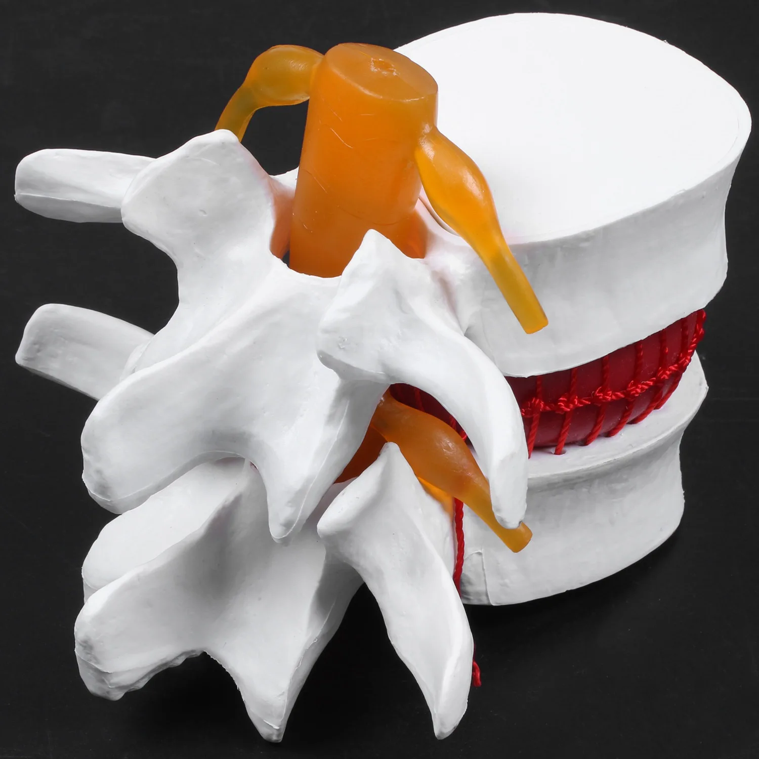 Esqueleto de anatomía humana, columna vertebral, hernia de disco Lumbar, modelo de enseñanza, cráneo cerebral, suministros escolares traumáticos, instrumento
