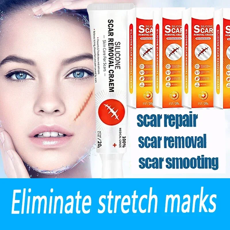 

Stretch Mark Remover Permanent Stretch Mark Removerstretch marks remove scars