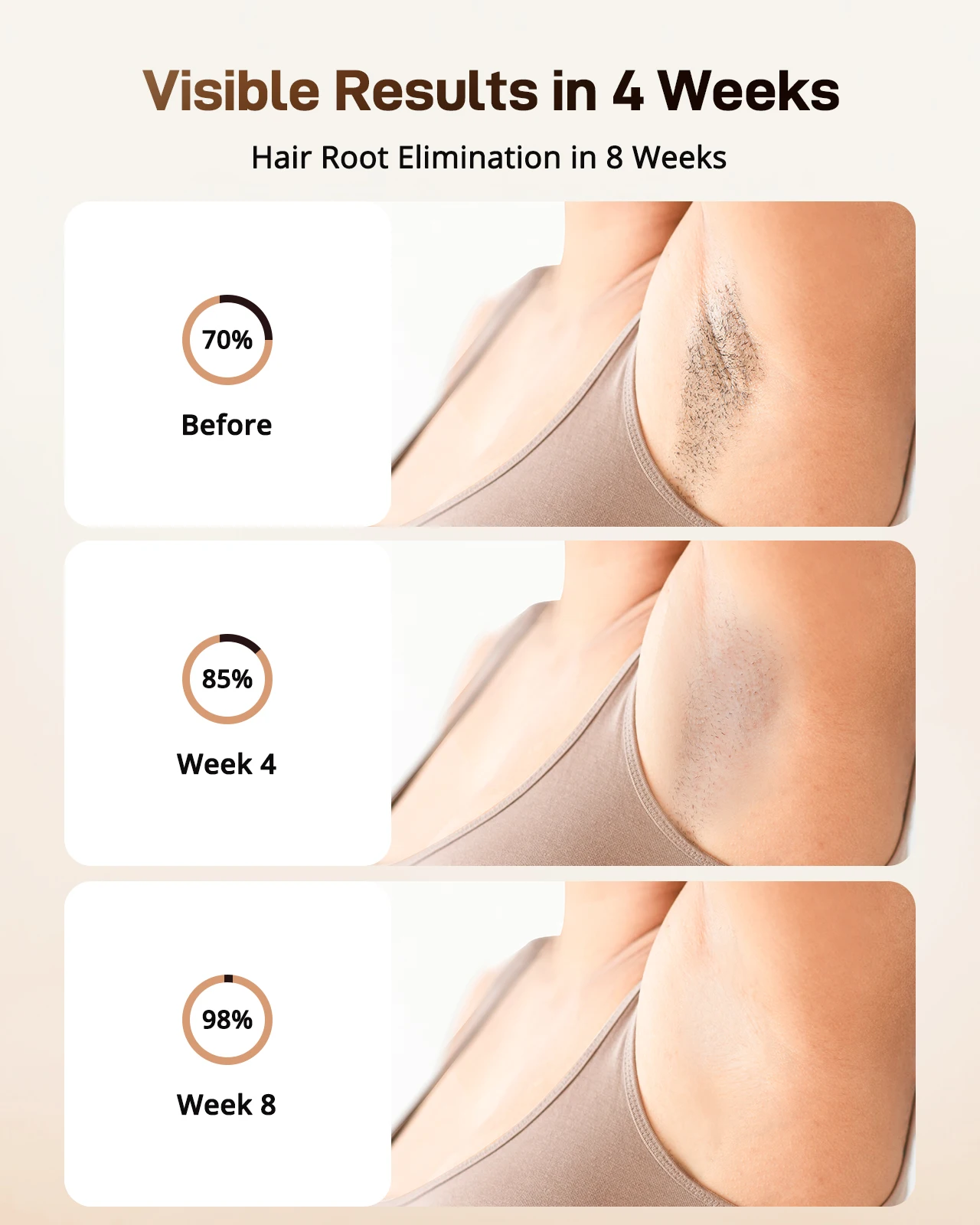 Thumbnail 4 - #36 Trending Hair Removal Devices Right Now