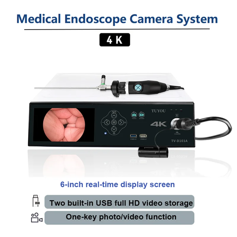 TUYOU 4k Uhd Medical Endoscopy Laparoscopic  System For Laparoscopy Hysteroscopy Diagnostic