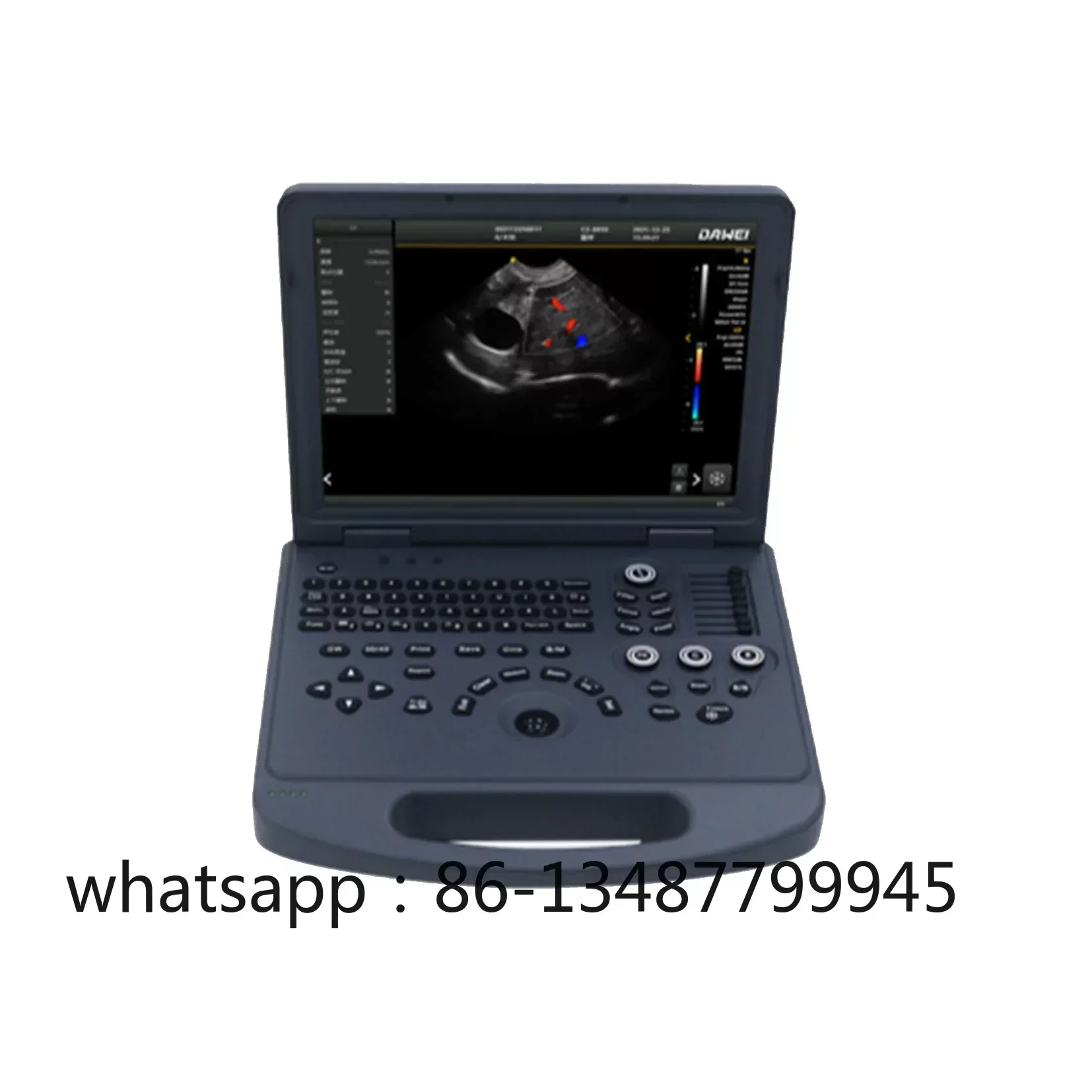 For Animals Portable Vet Doppler Ultrasound Diagnostic System Veterinary Ultrasound