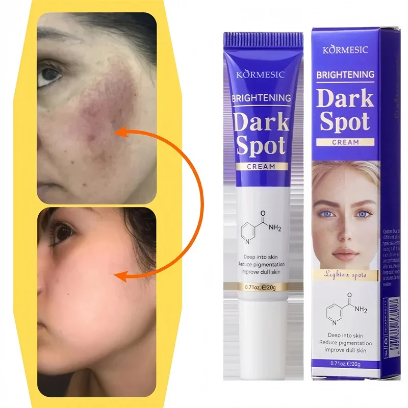 

Dark Spots Removal Cream Facial Whitening Freckle Acne Mark Pigmentation Removal Melanin Skin Correction Brighten Care Products