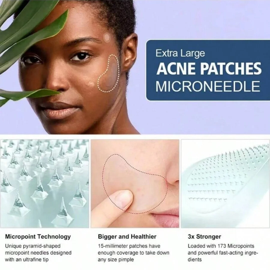 Ensemble de masques d'élimination des yeux et des points noirs, Nano micro-aiguilles, nettoyage en profondeur des pores, Patch de soins pour la peau du visage, élimine les lignes du nez, 10 + 4 pièces