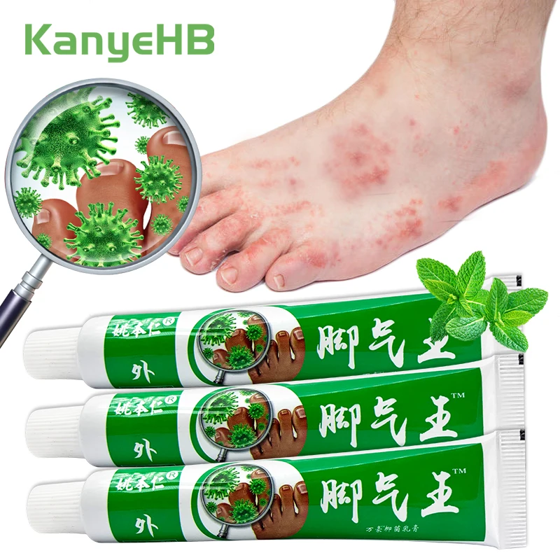 

3Pcs Athlete's Foot Cream Fungal Infections Pain Peeling Itching Remove Sweat Odor Feet Anti Bacterial Herbal Ointment A1067