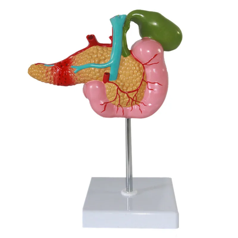 

1:1 Life Sized Pancreatic Duodenal Gallbladder Pathological Anatomical Model Gallstone Surgical Digestive System Splenic Model