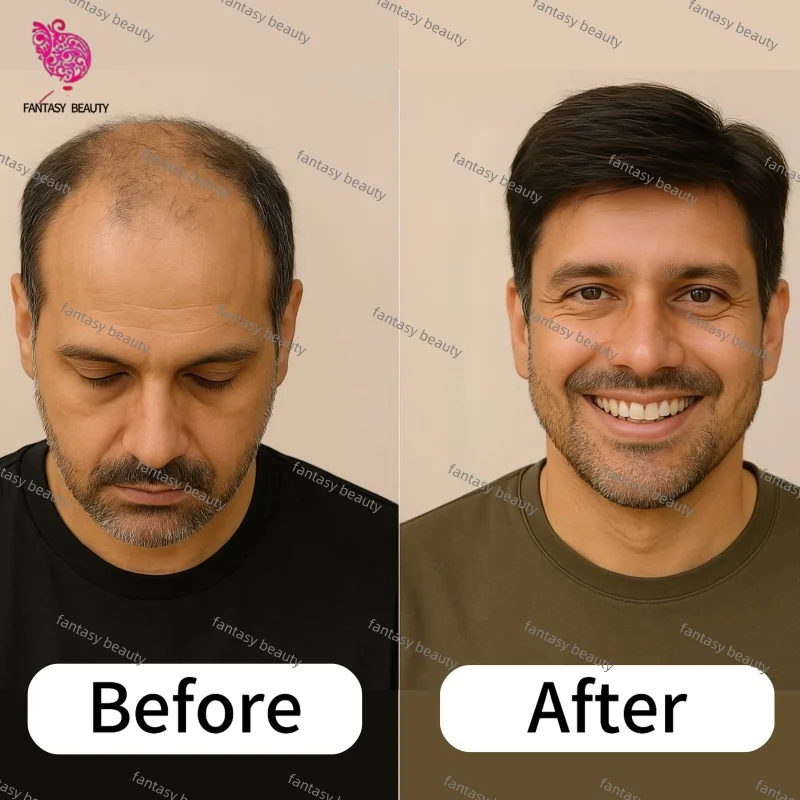 100% رماد حقيقي/بني فاتح شعر بشري شعر مستعار اصطناعي للرجال دانتيل سويسري قابل للتنفس وبولي يوريثان حول الرجال الشعر المستعار كثافة 110%-130% #6