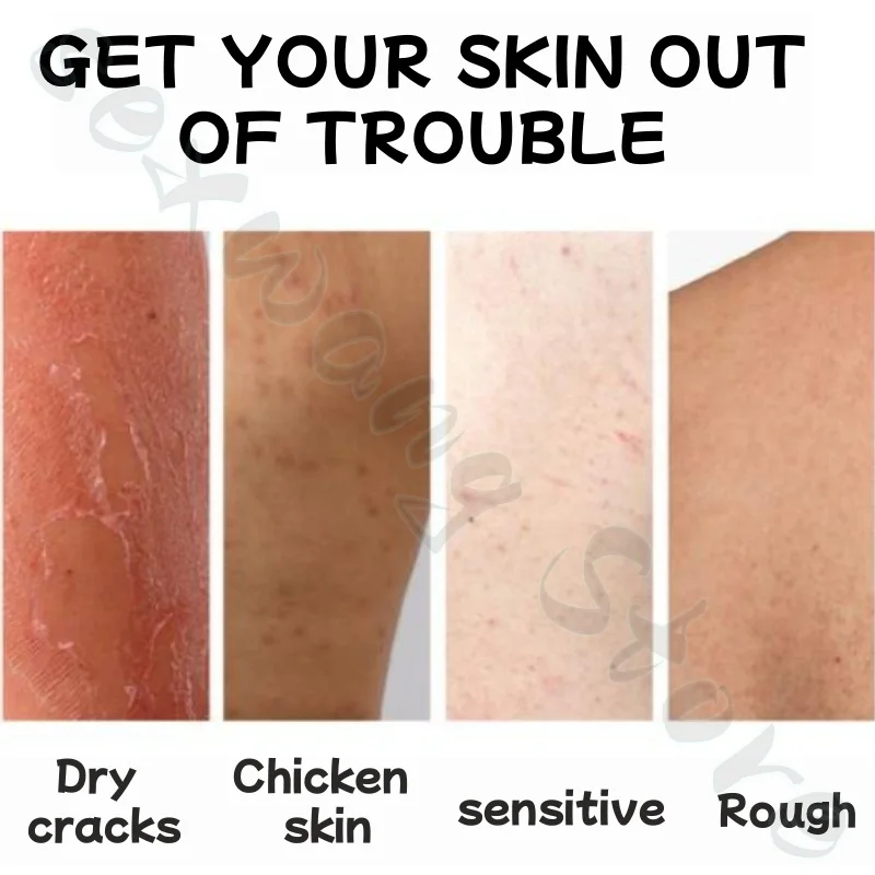 Peach fragrance body skin cream moisturizes and moisturizing the whole body can improve rough and dry chicken skin acne