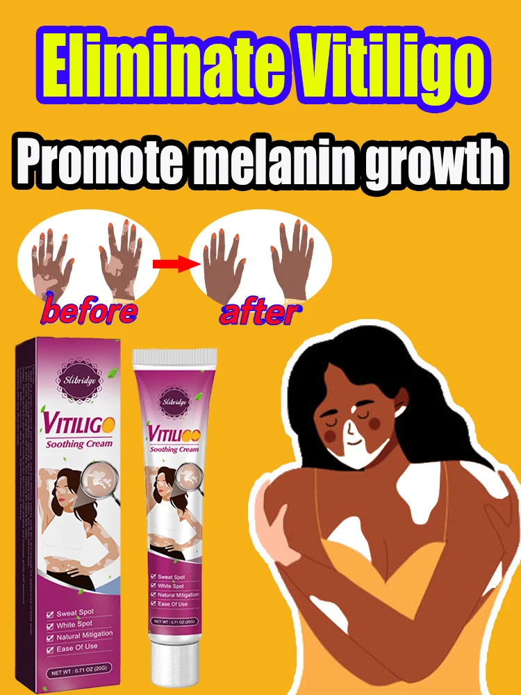 Crema de tratamiento de Vitiligo, pomada de crecimiento de melanina, eliminación rápida, Blanca