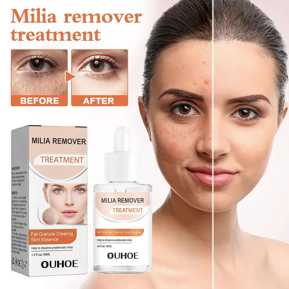 

30ml Milia Clearing Essence Remover Essence Fat Granule Aging Skin Under Serum Repair Acne Milia Clearing Anti Essence Anti V8I6