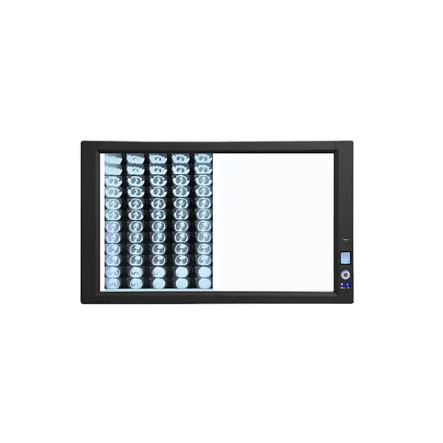 2026/Amcaremed Ultra-Bright LED X-Ray Film Viewer with Back Light Mode Medical Imaging Equipment