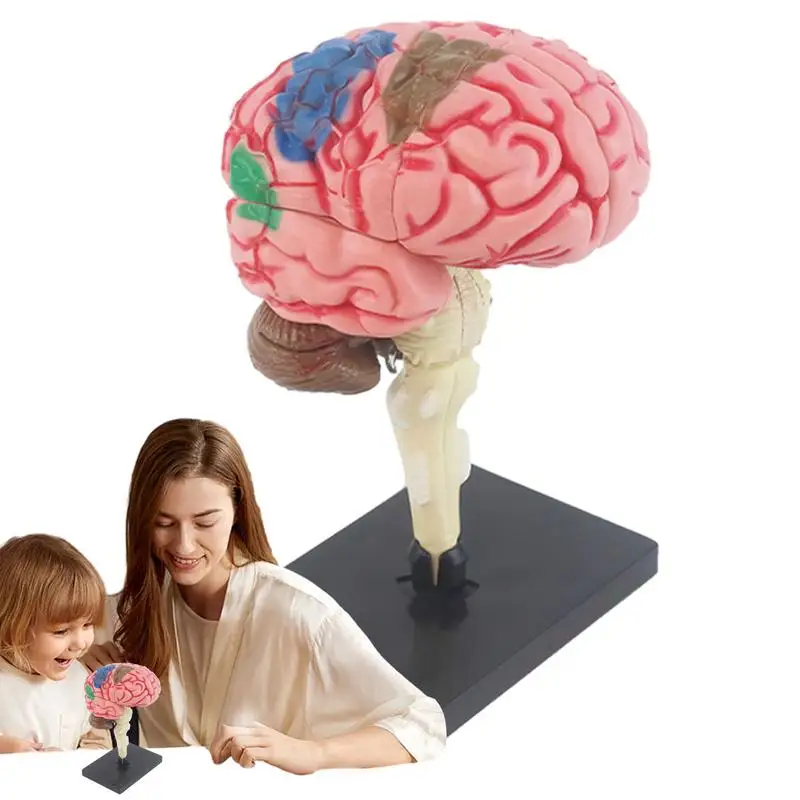 Modelo de cerebro para psicología, modelo anatómico, modelo médico de enseñanza con Base de exhibición, arteria codificada por Color, enseñanza de anatomía DIY