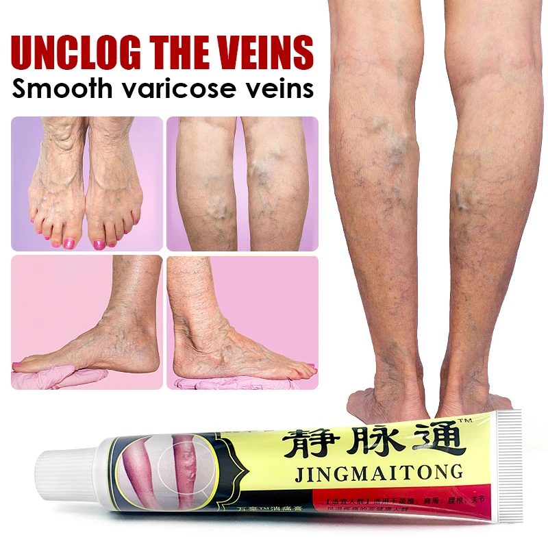 1pcs Varicose Vein Herbal Cream Leg Veins Skin Care Varicosity Ointment Anti-swelling Varicocele Varices Medical Plaster S084