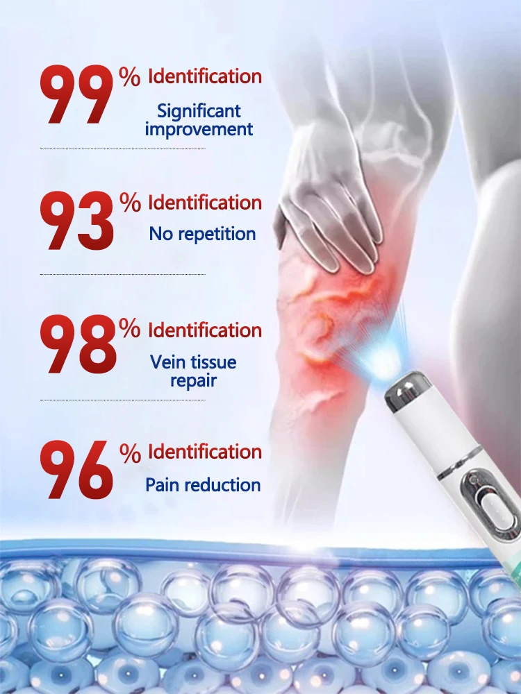 Bolígrafo optimizador de venas 2025: para venas varicosas, dios adiós al enrojecimiento en las piernas