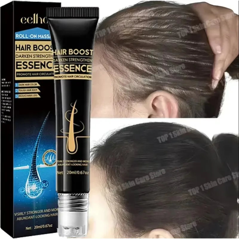 Rapid Hair Growth Roller for Thinning Hair - Visible Thickness Boost in 30 Days, Men & Women Approved