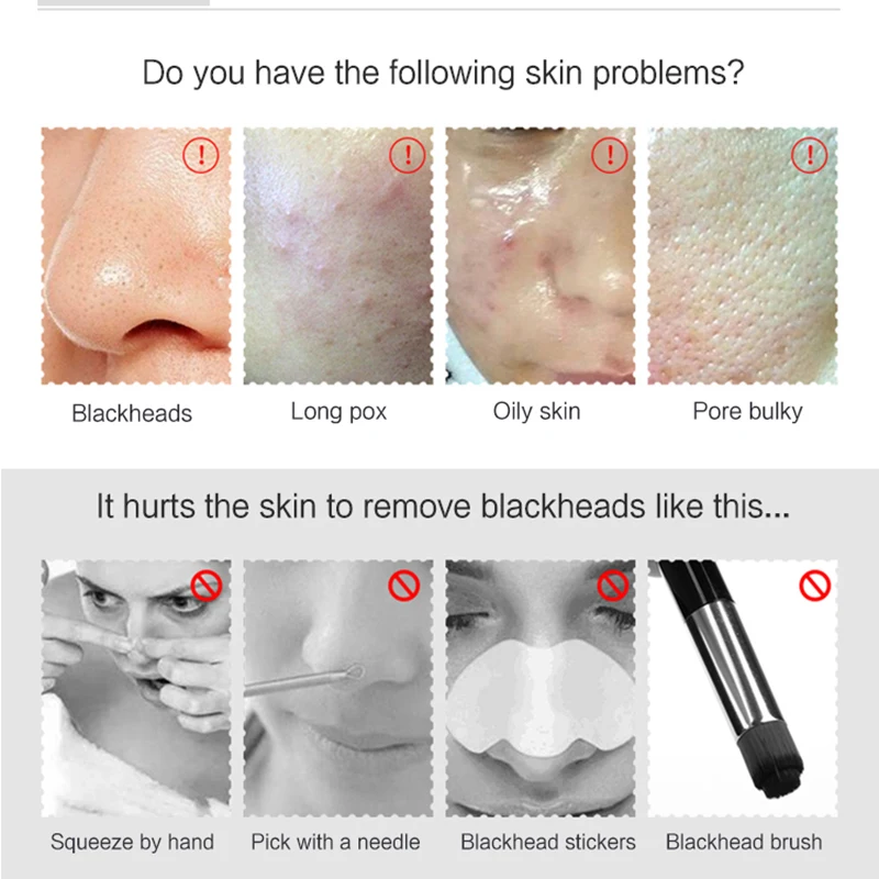 ไฟฟ้า Blackhead Remover เครื่องดูดฝุ่นจุดด่างดํากําจัดใบหน้าทําความสะอาดลึก Pore CLEANER เครื่อง Face Skin Care เครื่องมือ US