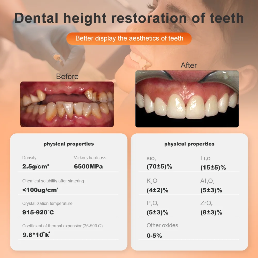 Dental Press Lithium Disilicate Glass Ceramic Block Ingots Materials HT/LT for Ultra-thin Veneer Dentist products 5Pcs 2024 NEW