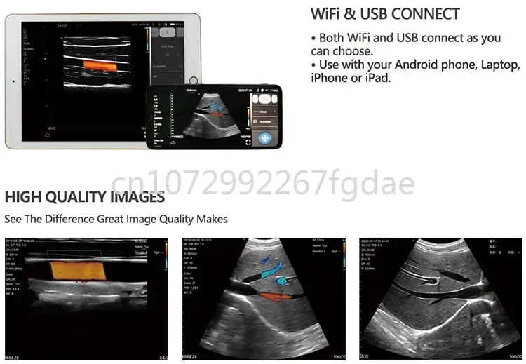 Three in One Linear Convex Dual Probe Smartphone USB WIFI Sonda De Ultrasonido Portable PICC Wireless Ultrasonic Probe