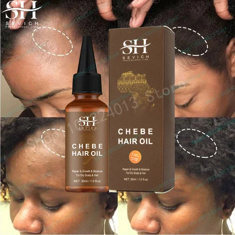 

Sdottor Chebe Traction Alopecia Thicken Oil Anti Hair Loss Treatment Spray Craze Fast Hair Growth Products Sevich Anti Break Hai