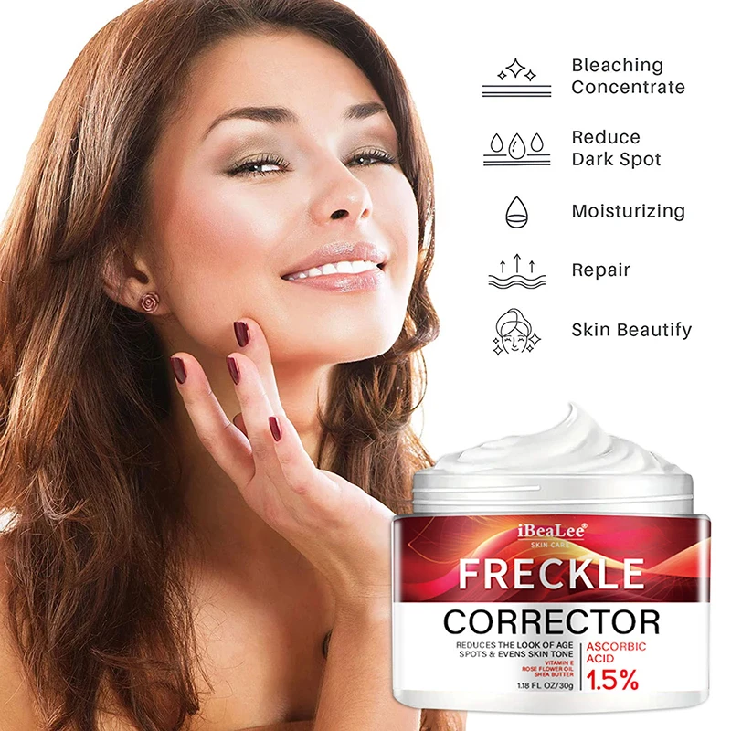 Freckle Whitening Cream, pontos pretos, removedor de melasma, mancha anti marrom, clarear a pigmentação, hidratante, cuidados com a pele, produtos coreanos