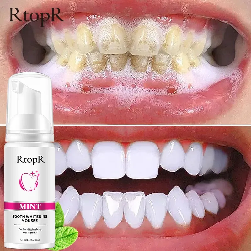 Mint Teeth Whitening Mousse Cleans The Mouth, Freshens The Breath, Cleans The Stains, Protects The Gums, Cleans The Teeth