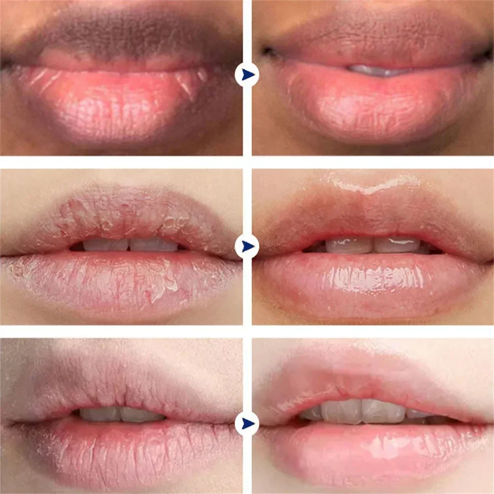 Entfernen Sie dunklen Rauch Lippen balsam Aufhellung Melanin Bleichen Glanz Öl Lippen rosa Lippenstift Peeling verblassen Lippen linien koreanische Kosmetik