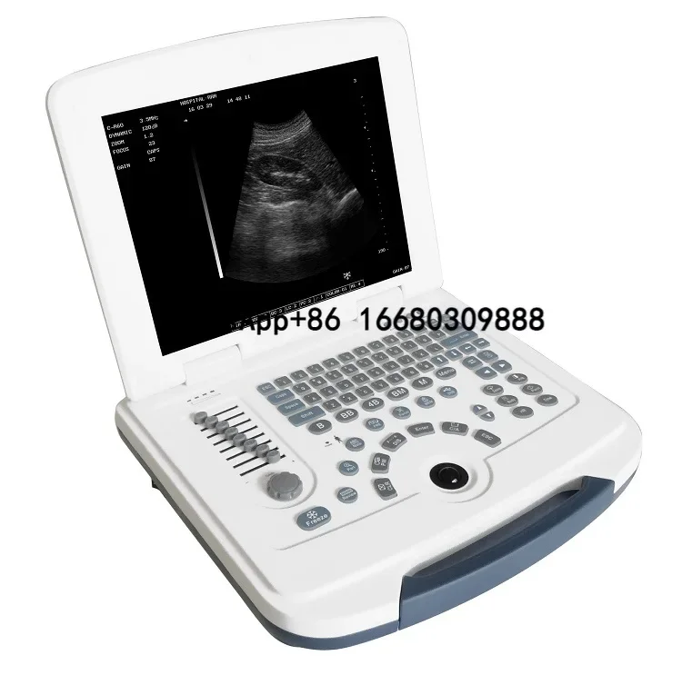 

B&W Ultrasound Machine Medical Full Digital Laptop Ultrasound Scanner Machine for Human/Veterinary