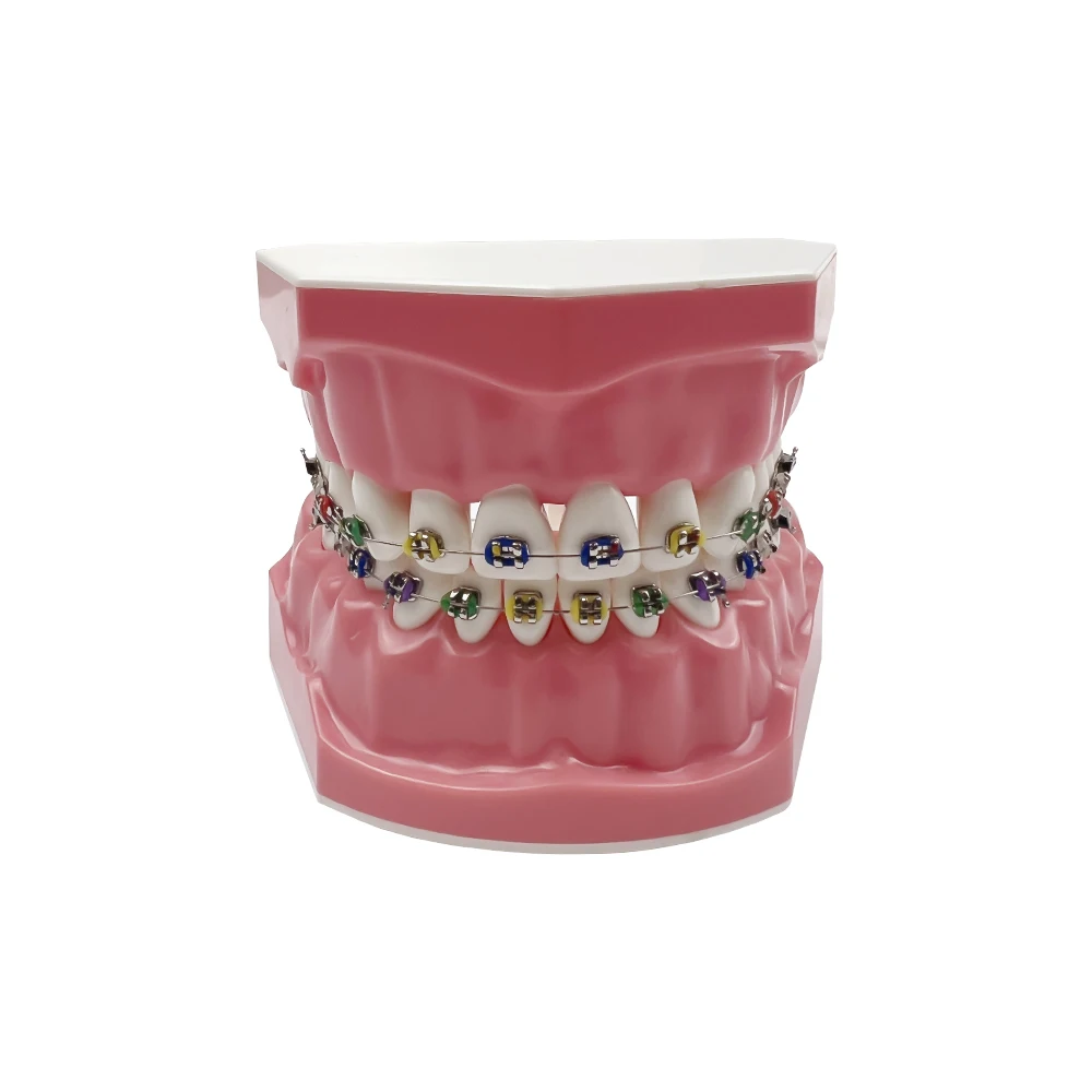 Modelo de ortodoncia Dental de tamaño estándar 1:1 con soporte, arco de alambre, Ligadura, corbata, Typodont, demostración para dentista,