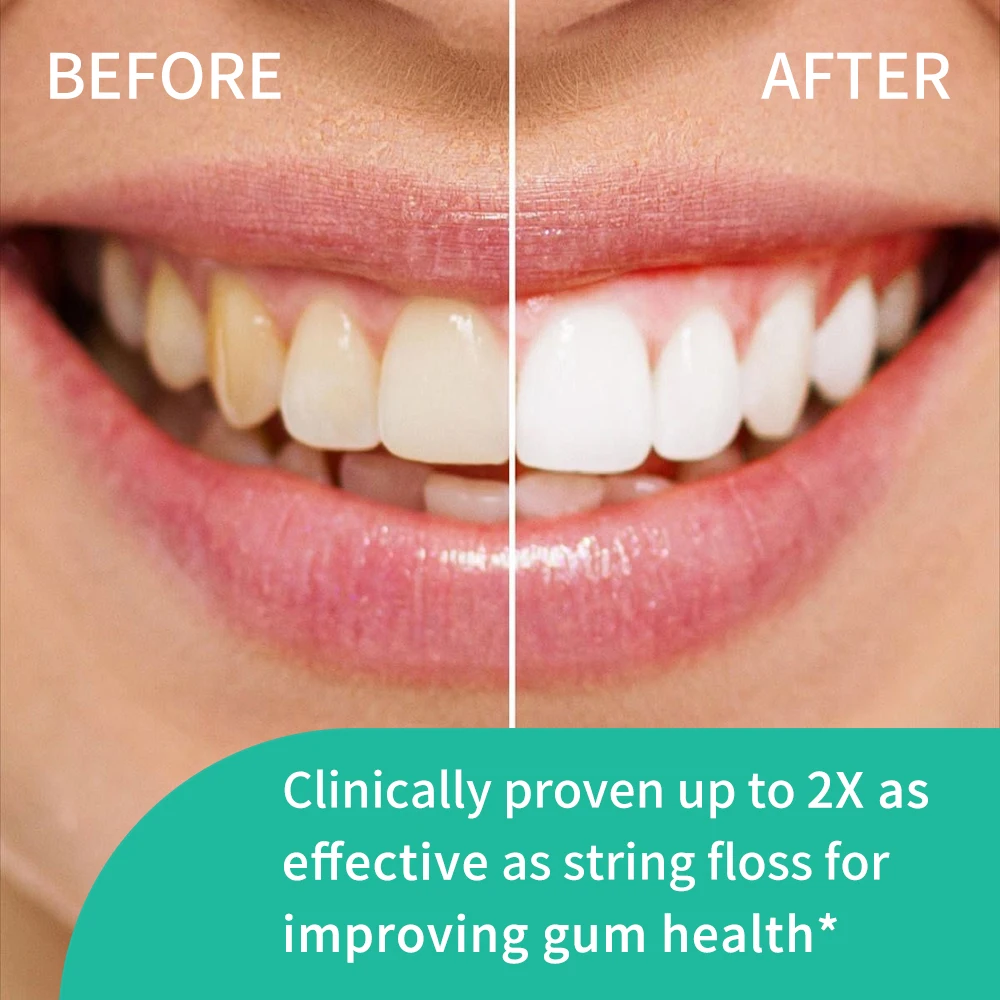 Thumbnail 3 - #71 Oral Care List of Top Picks