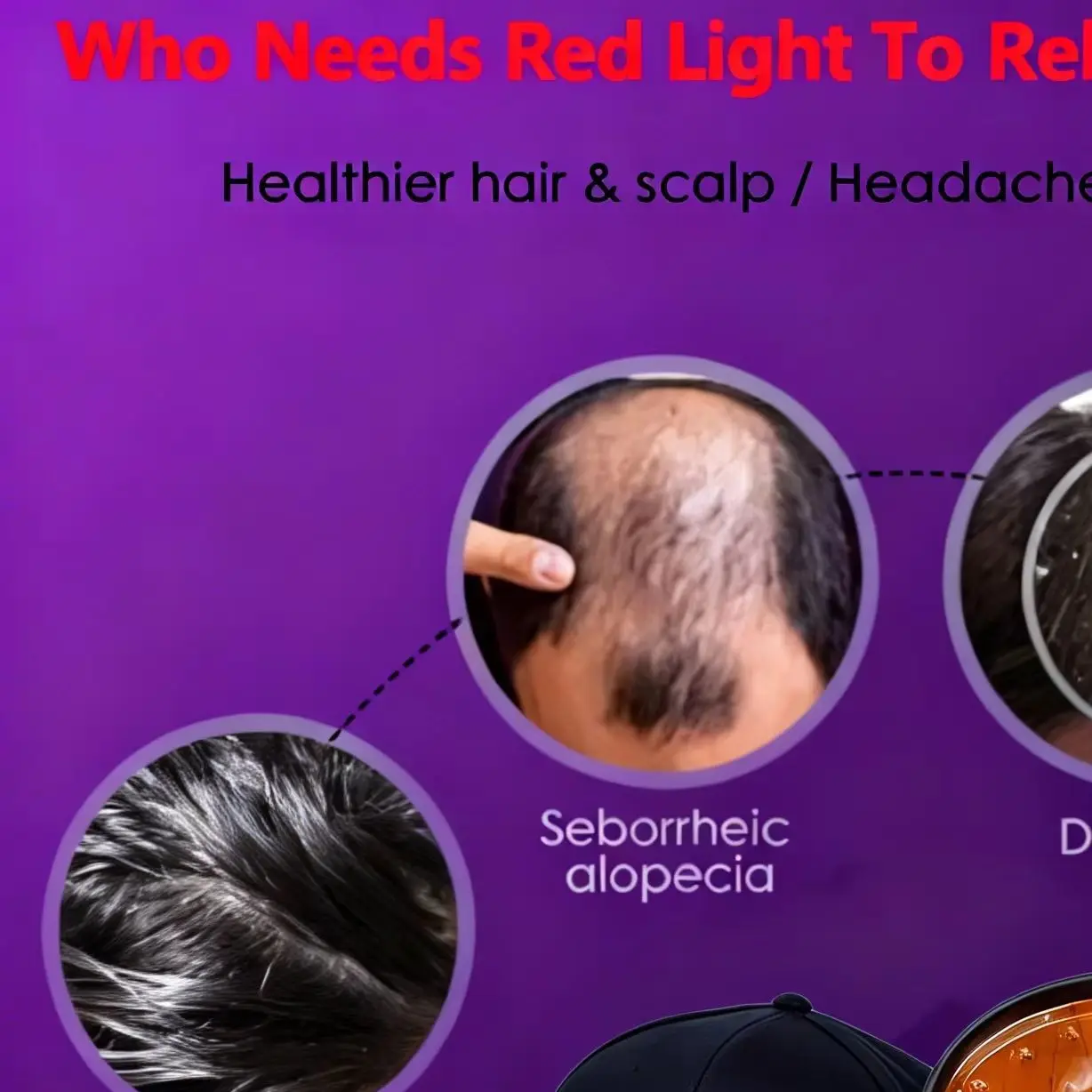 

Профессиональный лазерный аппарат для восстановления роста волос с 96 диодами, для лечения выпадения волос, полное покрытие кожи головы, для мужчин и женщин