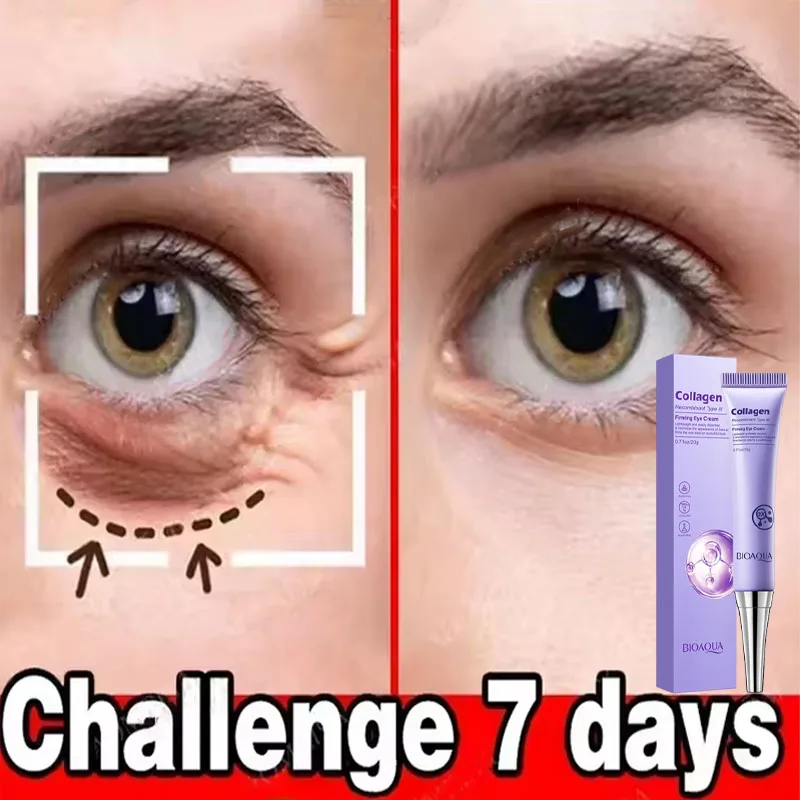 كريم إزالة حقيبة العين الفورية ريتينول المضاد للتجاعيد رفع ثبات تتلاشى الخطوط الدقيقة مكافحة الانتفاخ الدائرة الداكنة سطع العناية بالعين #3