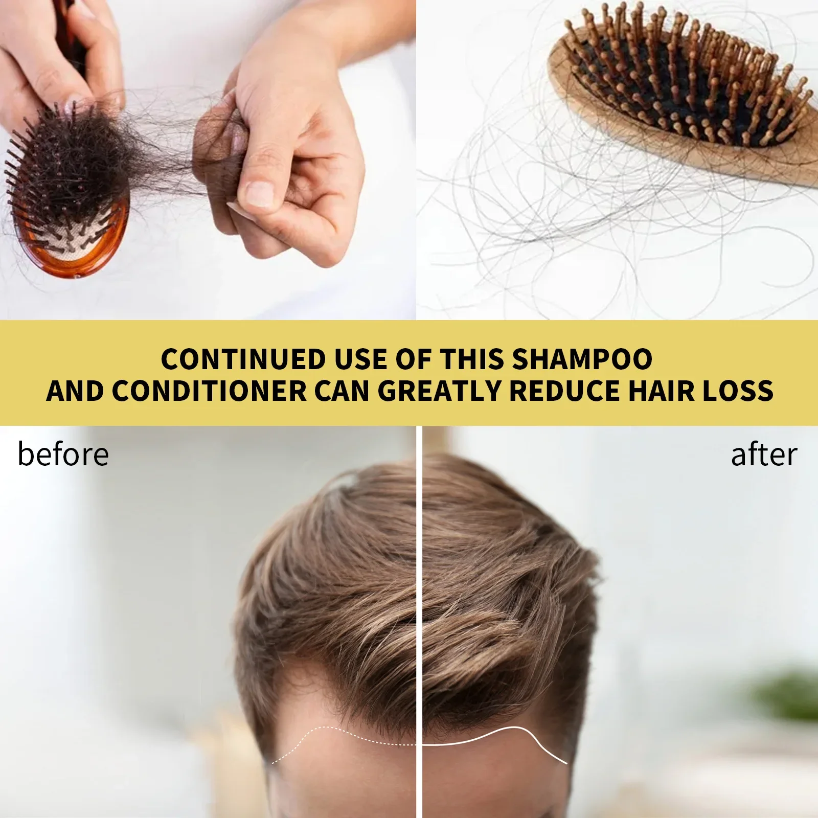 Champú para el crecimiento del cabello denso, nutritivo y esponjoso para el cuidado del cabello, elimina la picazón