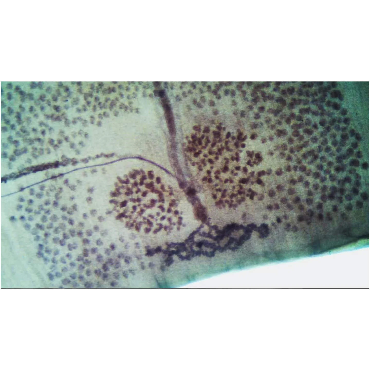 1 Pieces Taenia Solium Mature Proglottid W. M Parasitoloy Prepared Slides