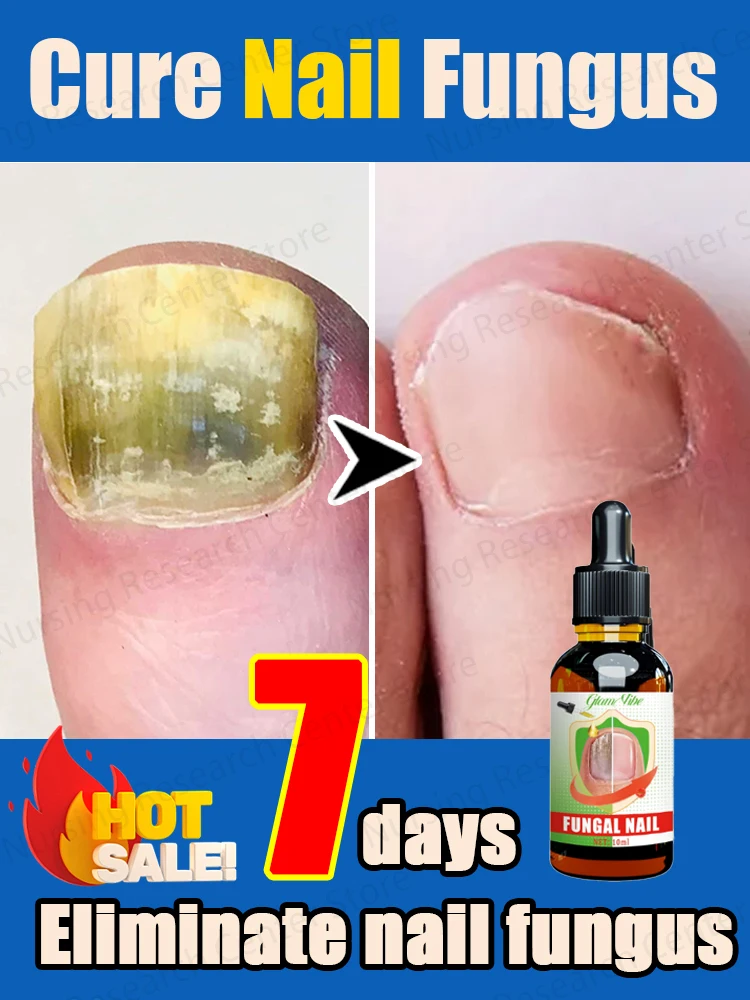 

Eliminate nail problems