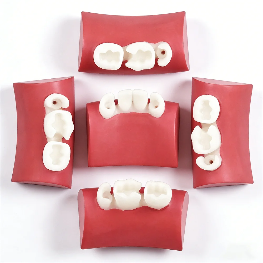 

5pcs Dental Practice Filling Teeth Model Resin Filling Inlay Exercise Model Block Root Canal Prep Restoration Simulator Typodont