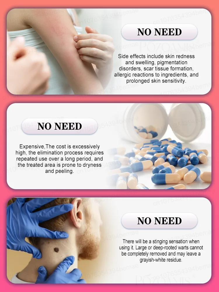 ʙʟᴜᴇ ʟɪɢʜᴛ ᴘᴇɴ sᴏʟᴠᴇ ᴡᴀʀᴛs, ʜᴏᴛ sᴀʟᴇ ᴡᴀʀᴛ ᴄᴀʀᴇ ᴛᴏᴏʟs