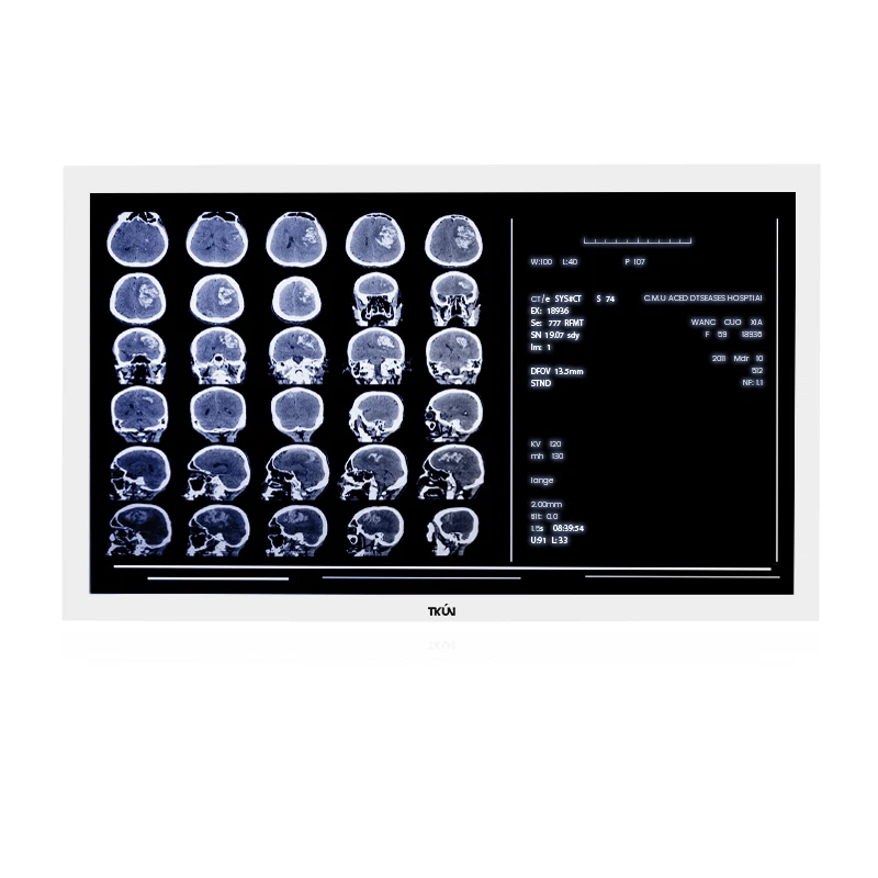 TKUN Pantalla de dispositivo endoscópico, alta definición médica, 32 pulgadas, se puede personalizar, Monitor de múltiples Interfaces