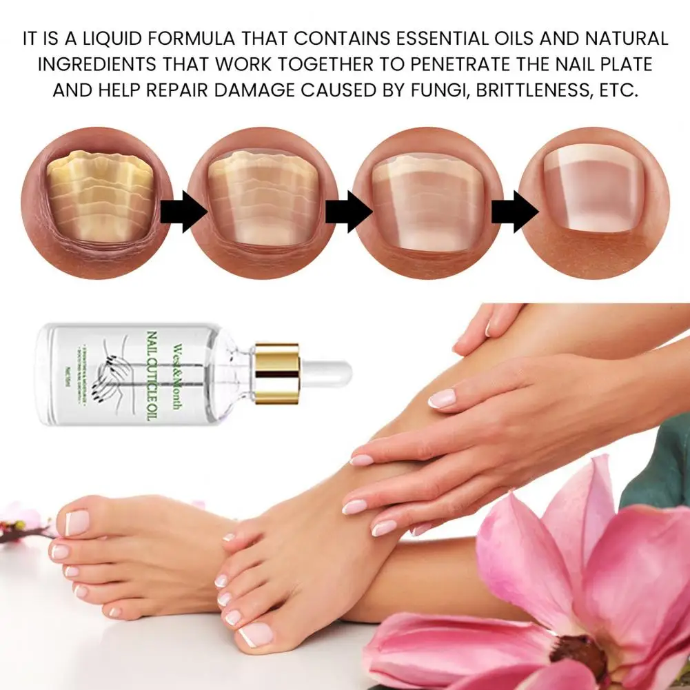 Nail Strengthening Oil น้ํามันบํารุงเล็บเพื่อสุขภาพเล็บ Moisturizing Cuticle Treatment สําหรับเล็บที่เสียหาย