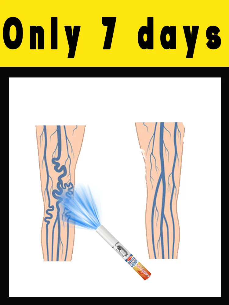 

Remove varicose veins in just 7 days