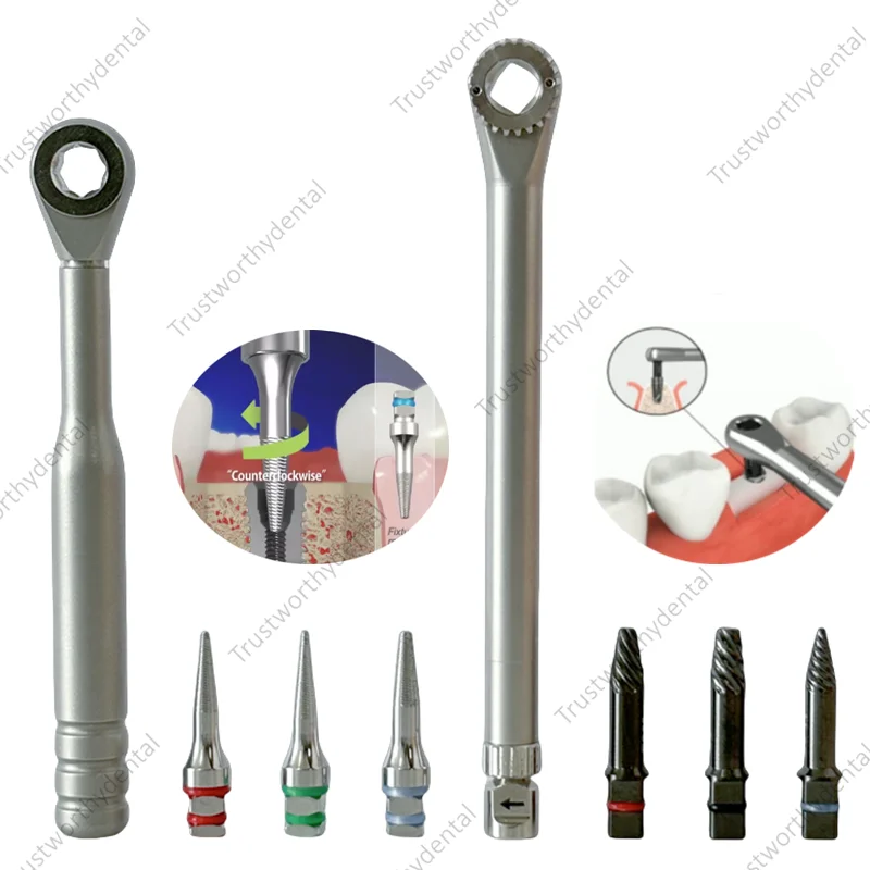 Broken Fixture Remove Failed Screw Pick Up Extractor Remover Safe Dental  Marginal Bone Loss