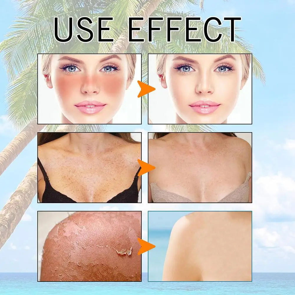 حمض الهيالورونيك ماء الشمس هلام الحليب ترطيب الجسم المضادة للأشعة فوق البنفسجية العزلة Isntree الأزرق كفاءة حماية واقية من الشمس