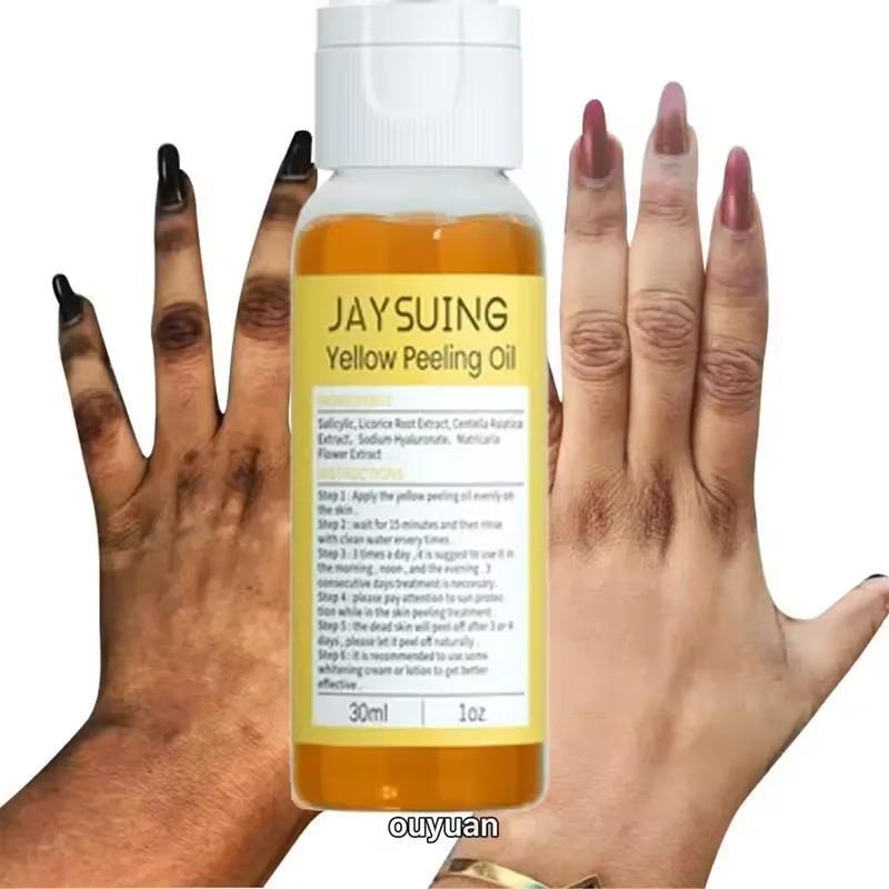 

Yellow Peeling Oil 100% Organic Bleaching Dark Skin Exfoliating For Tender Glowing Skin Finger Joint Whitening Moisturizing Care