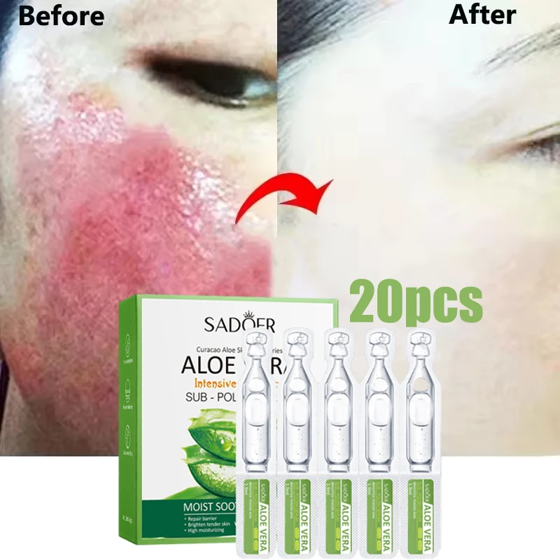 

7 Day Repair Redness Serum Sooth Itching Sensitive Skin Improve Rosacea Shrink Pore Smooth Nourish Facial Skin Korean Cosmetics
