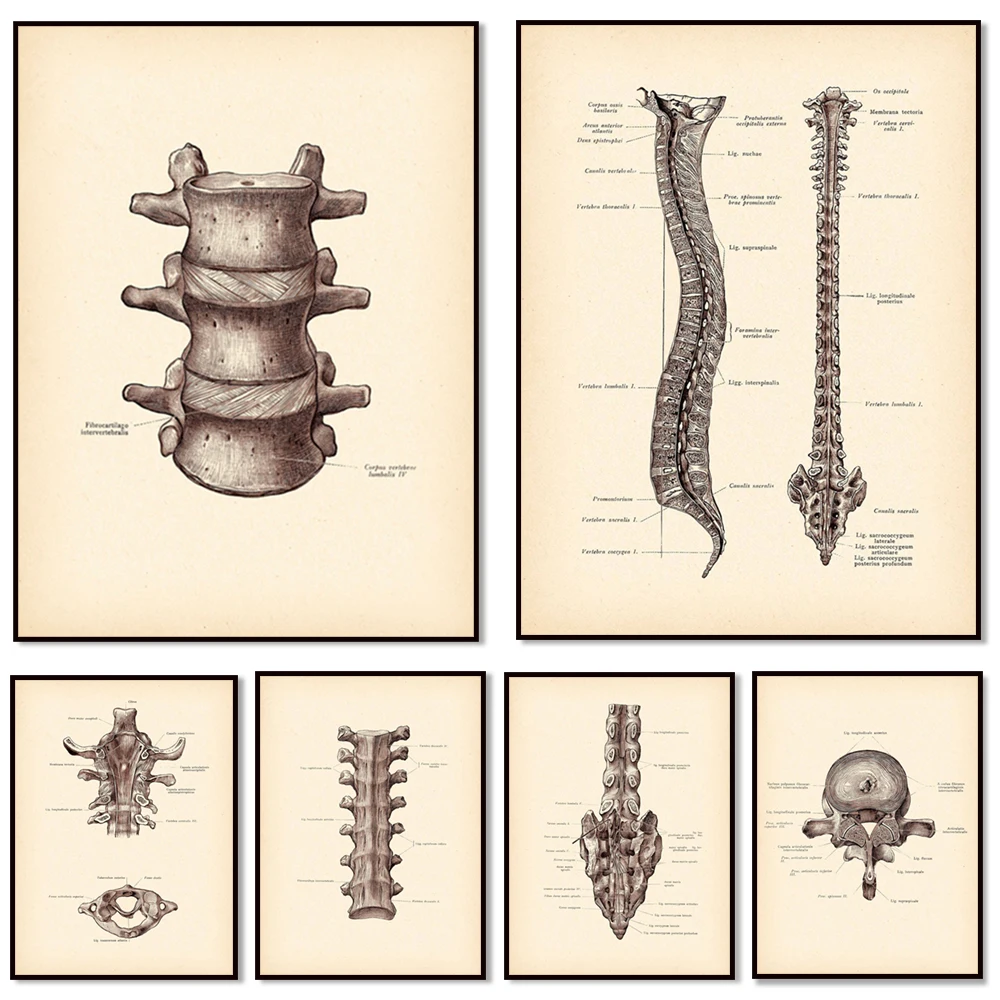 (2D canvas painting)  Spine Anatomy Print, Spine, Spine Structure Vintage Poster, Medical Art, Chiropractor Gift, Physiothera