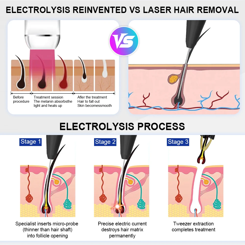 Permanent Hair Removal Machine with Hot Cold Hammer Epilator Blend Electrolysis Hair Removal Machine for Face Body Bikini