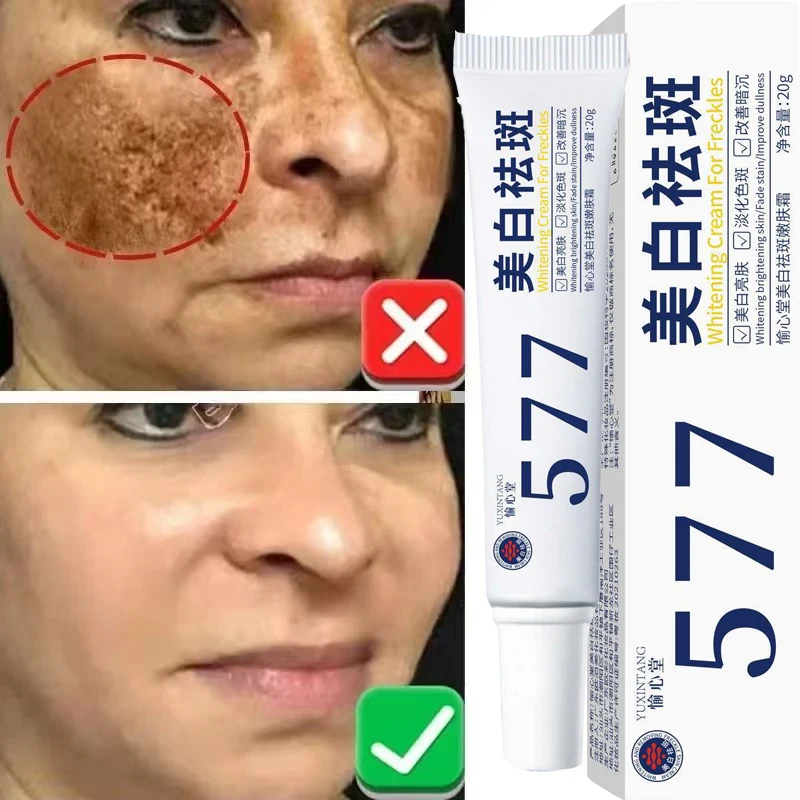 美白そばかすクリーム、肝斑、シミ、色素沈着除去製品、メラニン色素沈着を速く修復し、明るい韓国スキンケアを実現 1