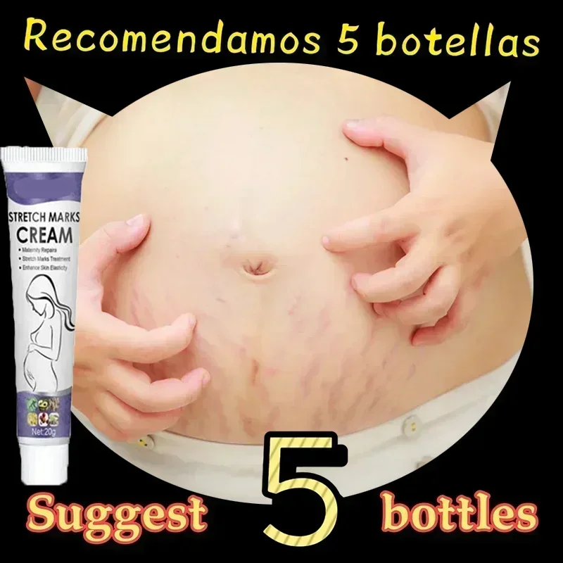 Fades Stretch Marks And Special Skin Care Oil For Pregnant Women