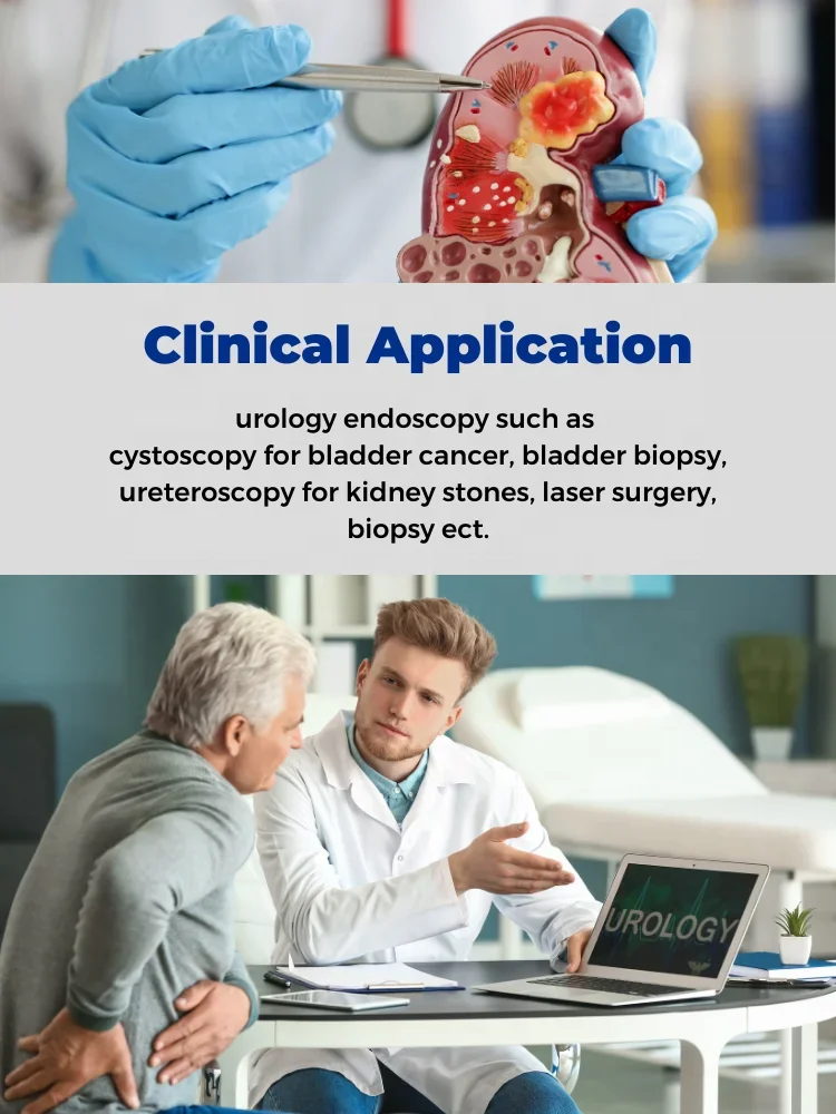 7,5 Fr 8,5 Fr 9 Fr Einweg-Ureteroskopie und Lithotripsie Einweg-digitale flexible Einweg-Ureteroskope zum Verkauf