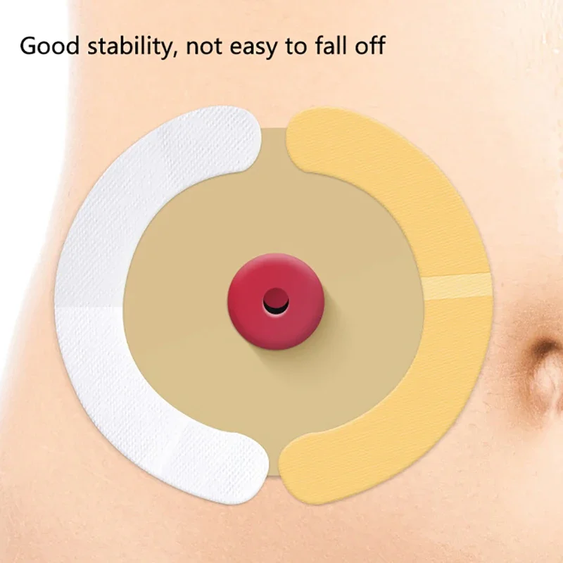 20 قطعة شرائط حاجز فغرة الماء المرنة مقاوم للماء مانعة للتسرب شريط لاصق للجلد لتغيير كيس فغر القولون