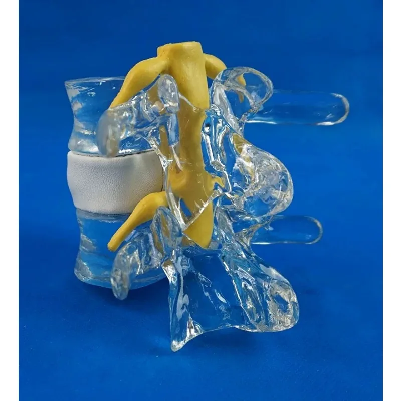1.5X Human Lumbar Spine Skeleton Anatomical Model Degenerative Lumbar Disc Herniation Demonstration Model Spinal Assist Tool